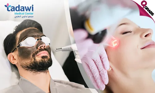 Glow & Renew: Spectra Bleaching, Carbon Laser & Fractional Laser!